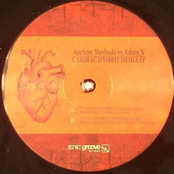 Cardiac Dysrhythmia Vinyl