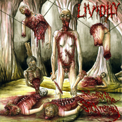 Anal Autopsy by Lividity