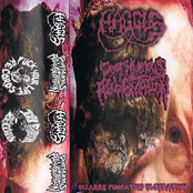 Bizzare Fungating Ulceration