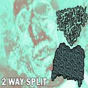 Epidemic Pain / Pulmonary Aspiration Of Vomit