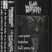 ...as your insides fall prey to black putrefaction