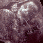 HOLD IT AGAINST ME NIKE7UP HELP I'M TRAPPED IN A BODY REMIX