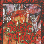 Sadistic Pathology