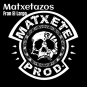Matxetazos