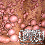 In Regard To Omnipresent Neurofibromatous Matters