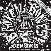 Dem Bones by Broken Bones