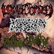 Esophageal Stricture