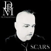 Scars