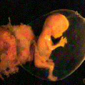 God doesn't like you.