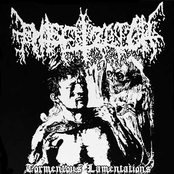 Tormentous Lamentations