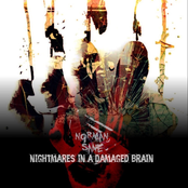 Nightmares in a Damaged Brain