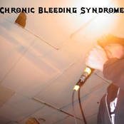 Chronic Bleeding Syndrome