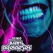 juan prolapsos