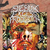 Traumatic Occupational Injuries