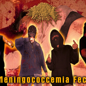 Meningococcemia Fecal