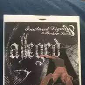 Fractured Dignity & a Broken Smile