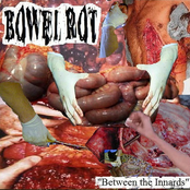 Between The Innards / Pulmonary Sequestion Of Uterinalist Arteries (Session A)