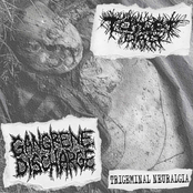 TRIGEMINAL NEURALGIA