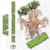 Inopexia / Dysmenhorrea - split tape