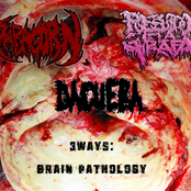 3Ways: Brain Pathology