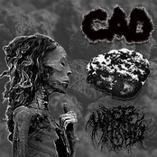 C.A.D. / CBD-BEAT / Vernal Keratoconjunctivitis