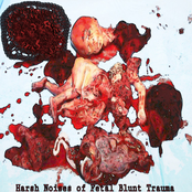 Harsh Noises of Fetal Blunt Trauma