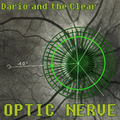 Optic Nerve