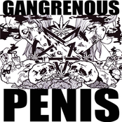 gangrenous penis