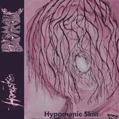 Hypomanic Skin