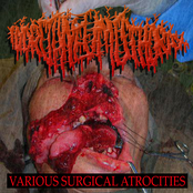 Various Surgical Atrocities