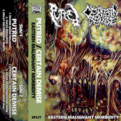 Eastern Malignant Morbidity