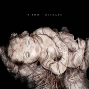 A Son: A Disease