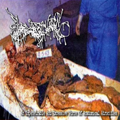 An Impenetrable and Excessive Force of Anatomical Atrocities