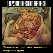 Техника Патологоанатомического Вскрытия Трупа