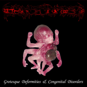 Grosque Deformities & Congenital Disorders