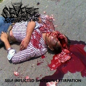 Self Inflicted Shotgun Extirpation