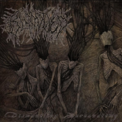 Dismantling Neuroanatomy [Explicit]