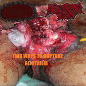 Two Ways To Rupture Genitalia
