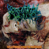 Splattered Synaptic Massacre