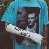 achy bones