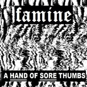 A Hand of Sore Thumbs