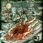 Failed Treatment / Basic Torture Procedure