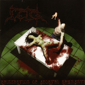 Reinsertion Of Aborted Remnants by Retch