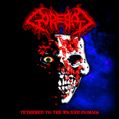 Regurgitated Eyeball Soup