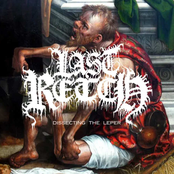 Dissecting the Leper