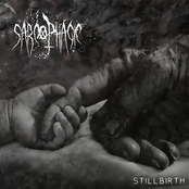 Stillbirth