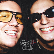 tooth gem