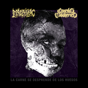 La Carne Se Desprende De Los Huesos