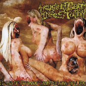 Fecal Matter Splatter by Malignant Germ Infestation