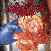 Abnormal Infestation Of Excreachollemical Putrescence